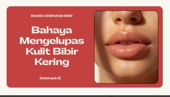 Bahaya Mengelupas Kulit BIbir Kering